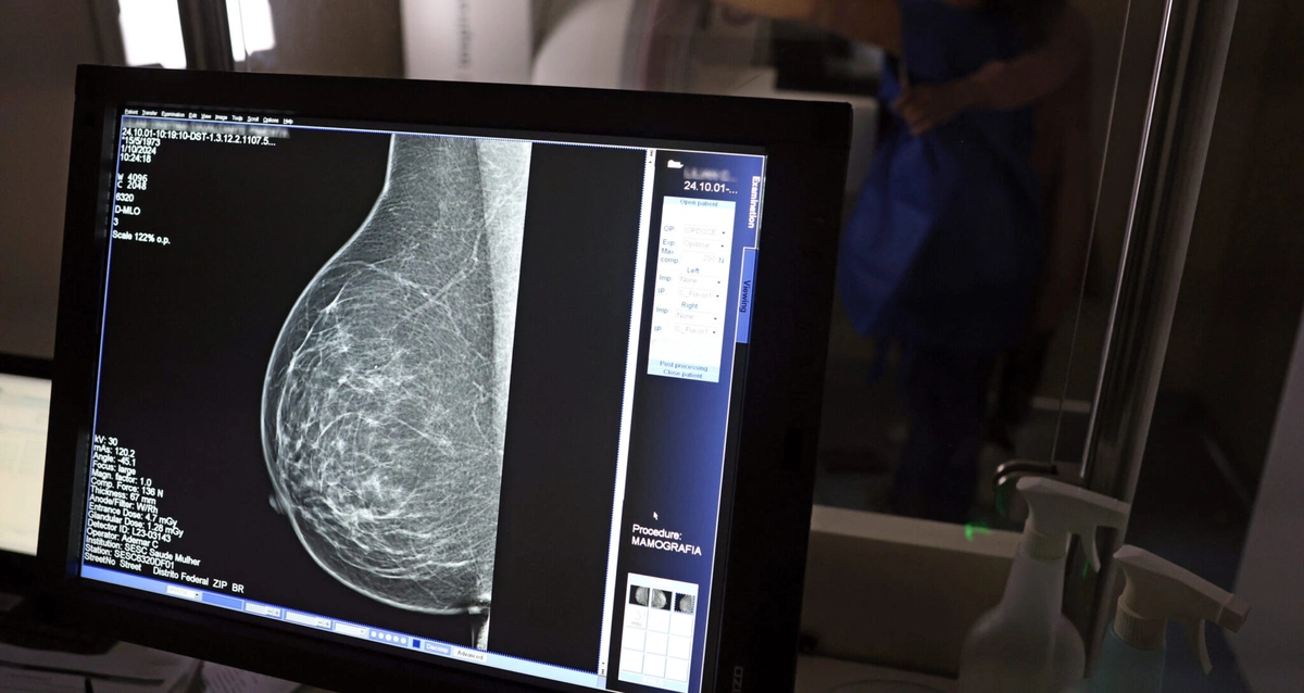 Teste de mamografia realizado na Campanha Outubro Rosa