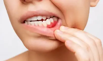 Câncer de boca exige atenção: prevenção e diagnóstico precoce salvam vidas