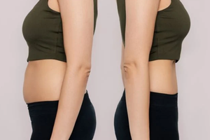 Para perder barriga de vez é melhor tirar esses 5 alimentos do cardápio (Foto: Kmatta/GettyImages)