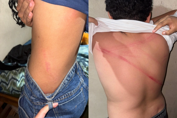 Agressão