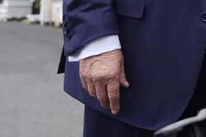 Mão de Trump em foto tirada no dia 15 de julho (Foto: Reprodução | REUTERS)