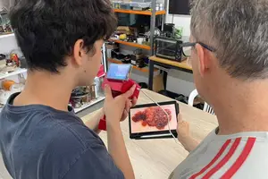 Arthur Duval e o professor Giovane Irribarem de Mello fazem leitura de sinal de pele com dispositivo que identifica suspeitas de câncer (Foto: Lucas Magalhães)