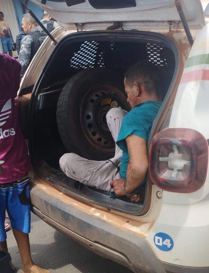 Assaltante Carlos Henrique chegou a levar uma pancada de facão no rosto