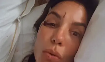 Ivete Sangalo é internada após desmaio e passa bem