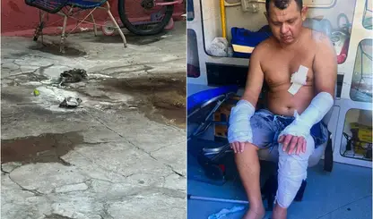 Mulher atacada pelo ex-companheiro morre após ter corpo queimado em Teresina