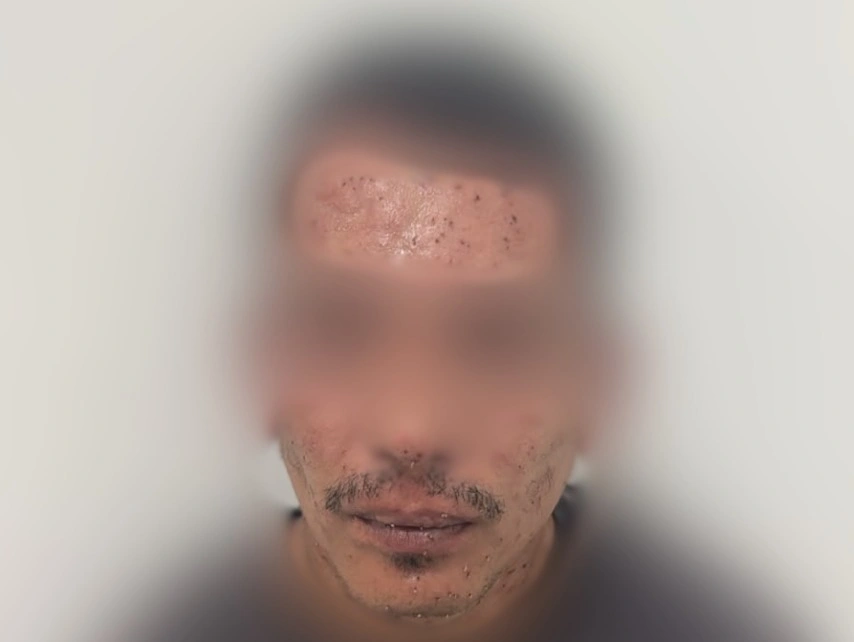 Suspeito de roubar carro foge da polícia e é atacado por abelhas em Teresina